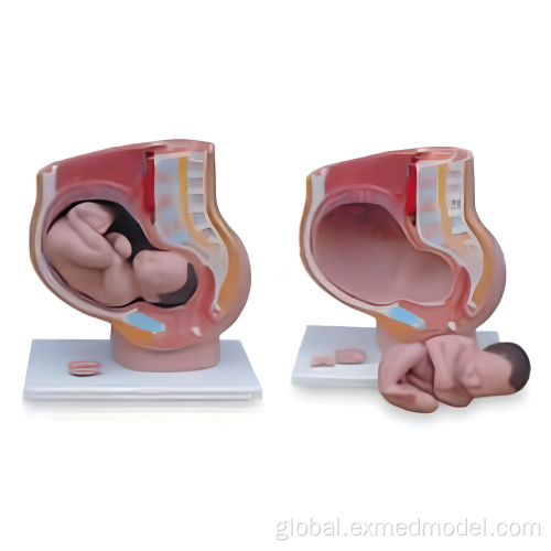 Postnatal Care Female Pelvis with Fetus Supplier
